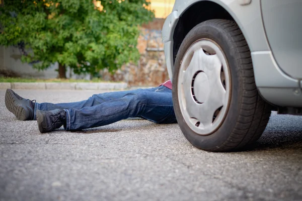 An injured man hit by a car needs a Columbia pedestrian accident lawyer.