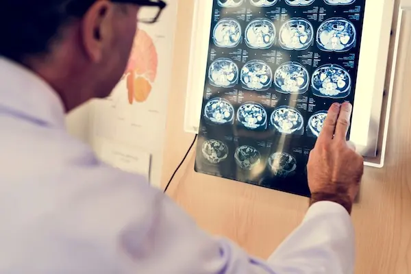 X-ray imaging used as medical evidence in an injury claim